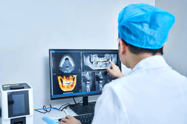 Best Knocked-Out Tooth (Avulsed Tooth) Treatment in Wilderness Rim, WA